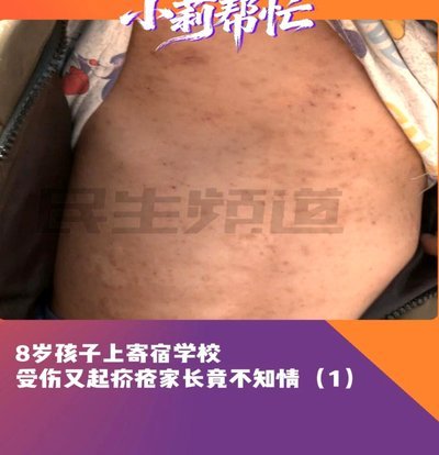 白条取现技巧与风险警示